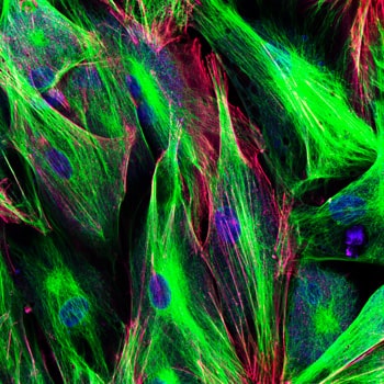 Cell-Matrix-Interactions